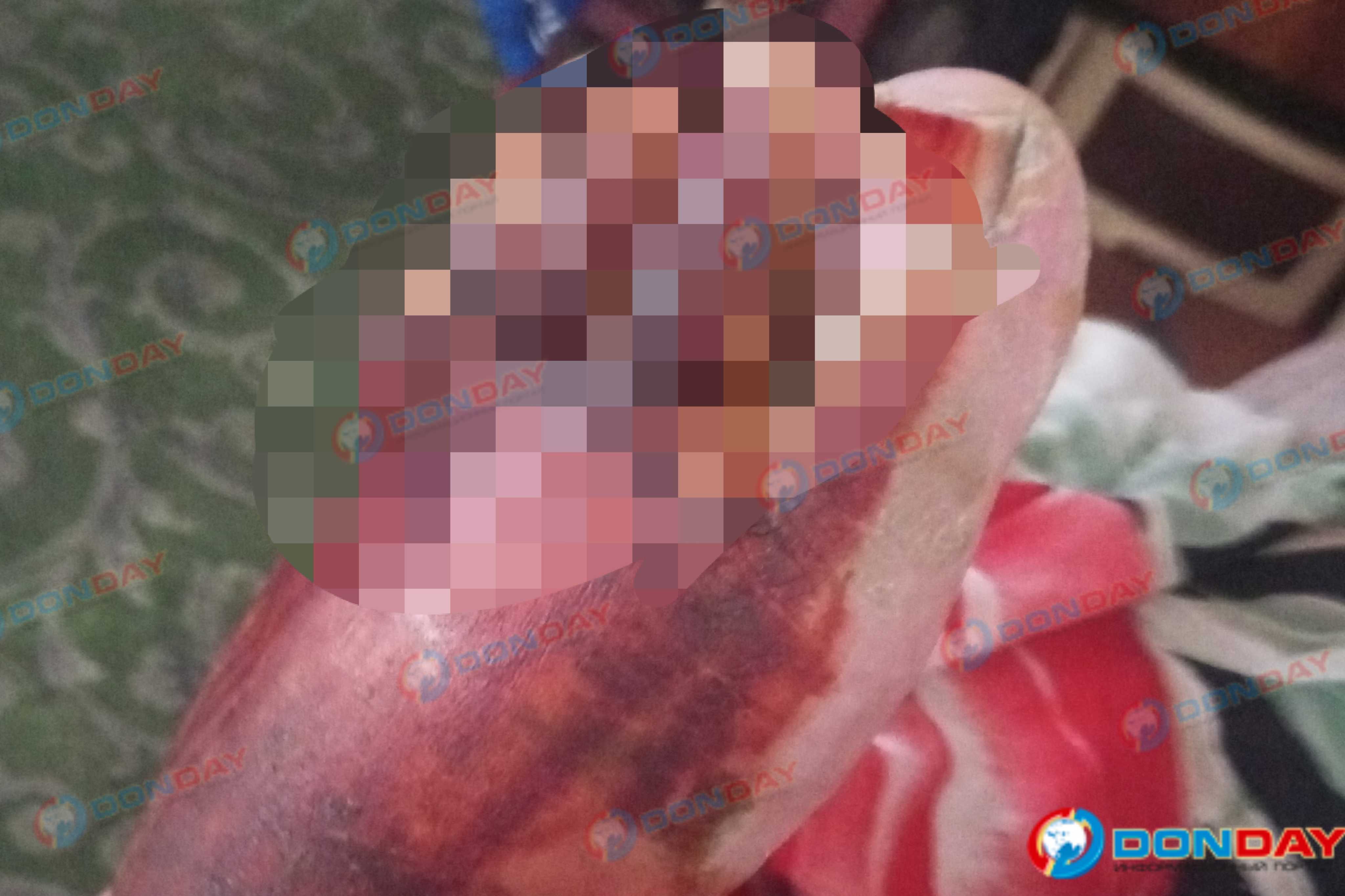 Жестоко избитый житель Новочеркасска три месяца ждёт возбуждения дела