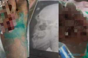 В деле об избиении жителя Новочеркасска пропали записи с камер